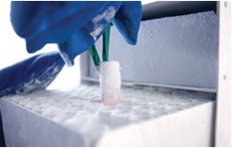 Biological Samples and Products in Freezers